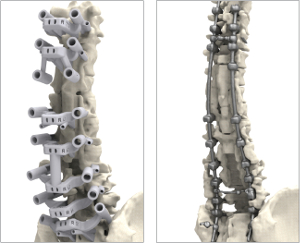 Comparação do Modelo Anatômico