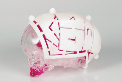 3D Systems VSP Cranial 3D Printed Model