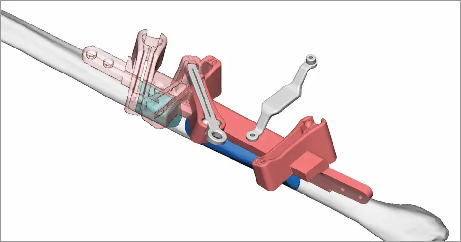 VSP - Planejamento cirúrgico virtual