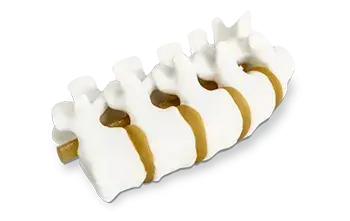 Modelo anatômico da coluna impresso em 3D pela 3D Systems