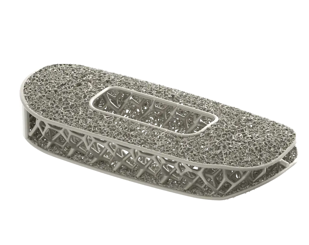 Implante espinhal otimizado pela NuVasive produzido usando a impressão 3D
