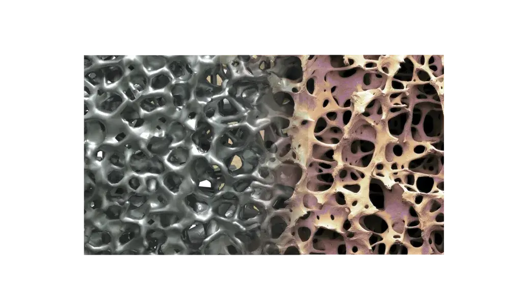 O design da linha de implantes espinhais Modulus da NuVasive foi projetado a fim de melhorar os resultados clínicos para pacientes com implante espinhal.