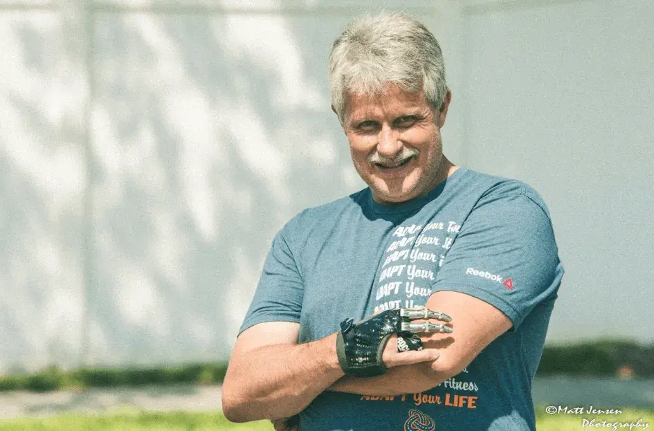 Jeff Soelberg usando sua prótese parcial de mão por Point Designs