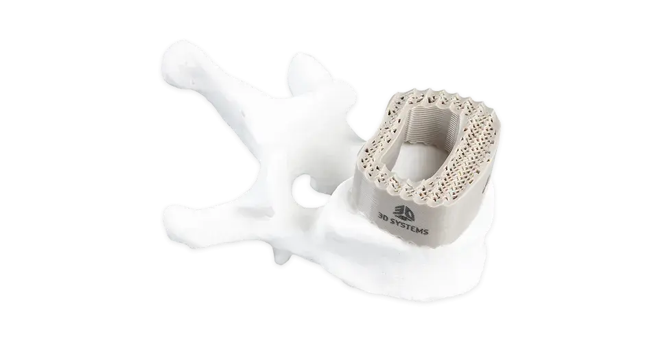 3Caixa espinhal impressa em D PEEK