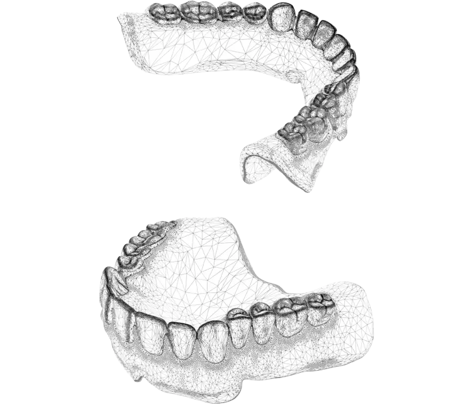 Arquivo CAD de produção NextDent