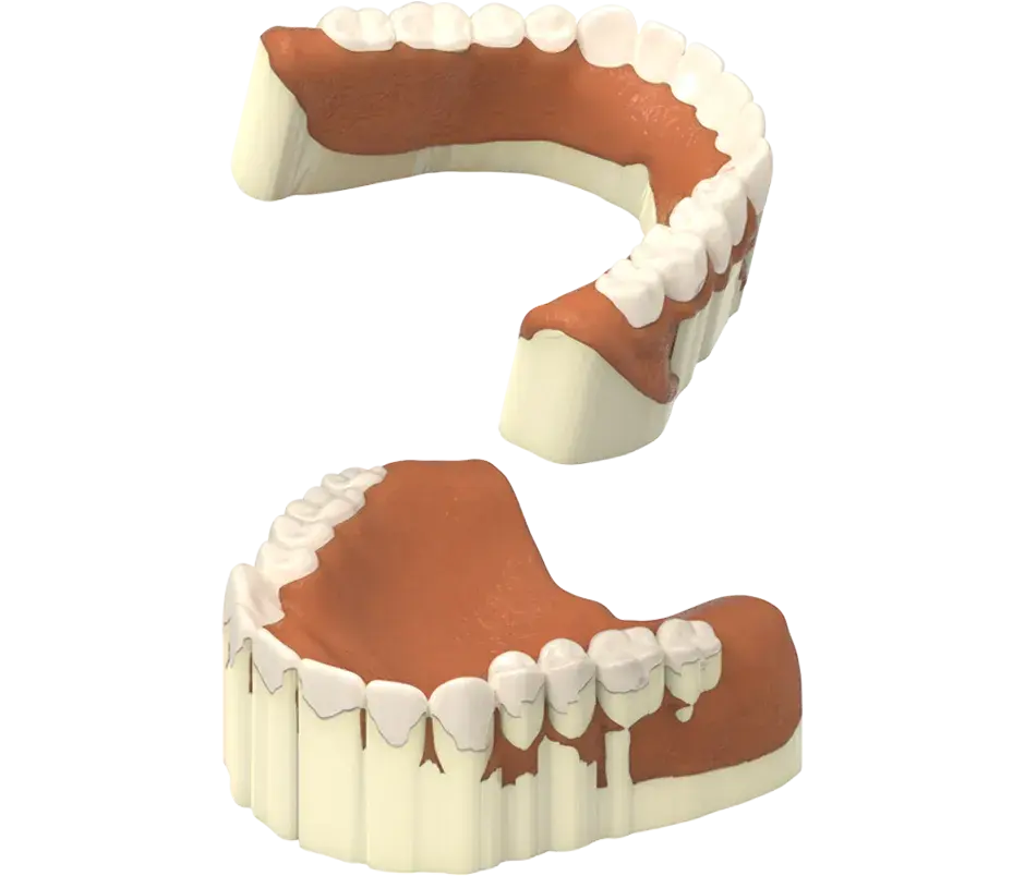 NextDent produção remover suporte