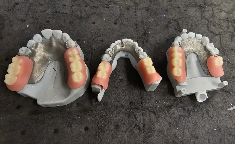 Peças odontológicas impressas em 3D