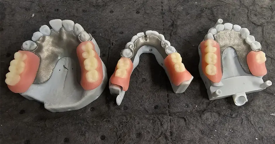 Próteses impressas em 3D