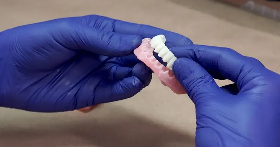 Um dentista segurando próteses impressas em 3D
